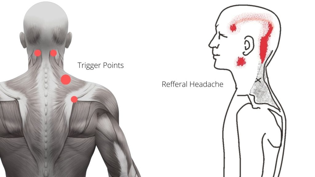 Neck exercise for discount headache